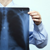 Életkoronként eltérő tüneteket okoz a tüdőgyulladás